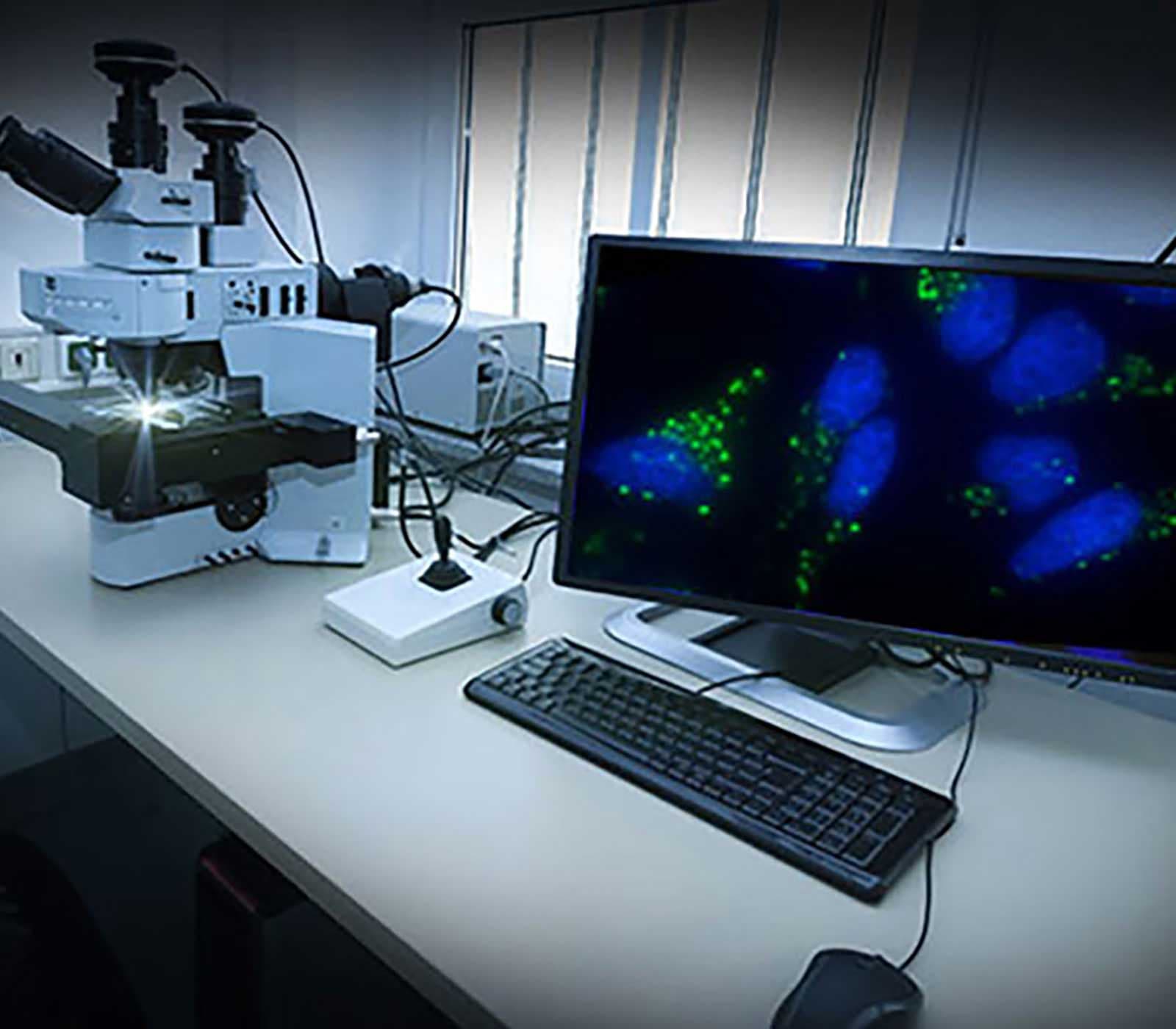 Inquire for Contract Services — Enzo Life Sciences
