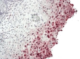 Chromogenic in situ Hybridization E-book